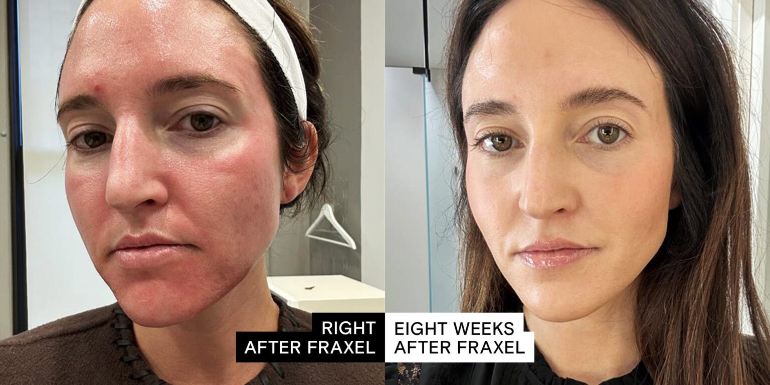 Medical laser device in modern dermatology clinic